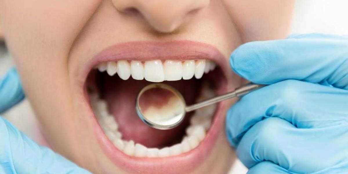 How Dental Problems Can Affect Your Heart?